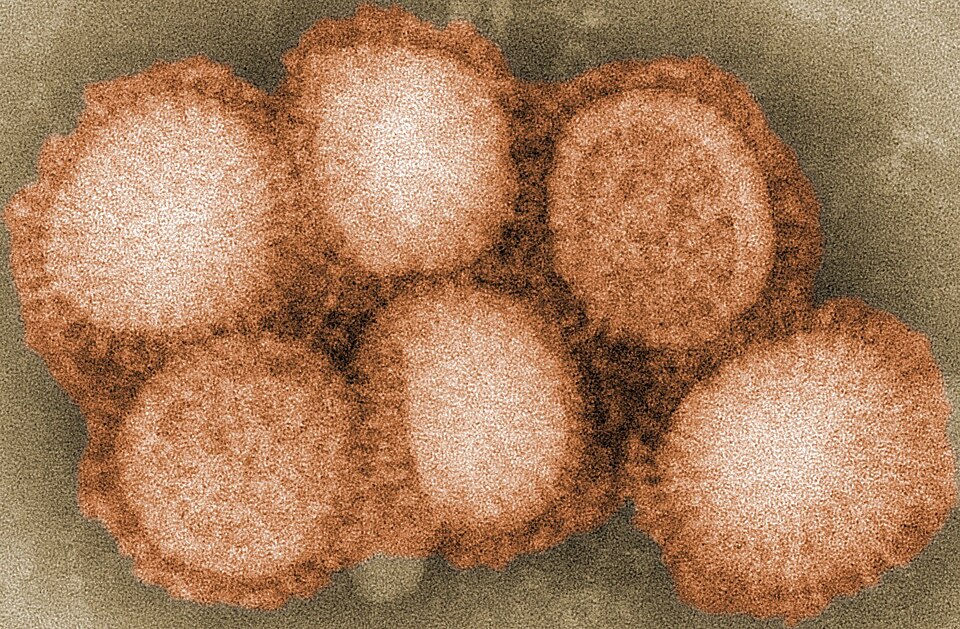 Australia to vaccinate vulnerable native birds against bird flu